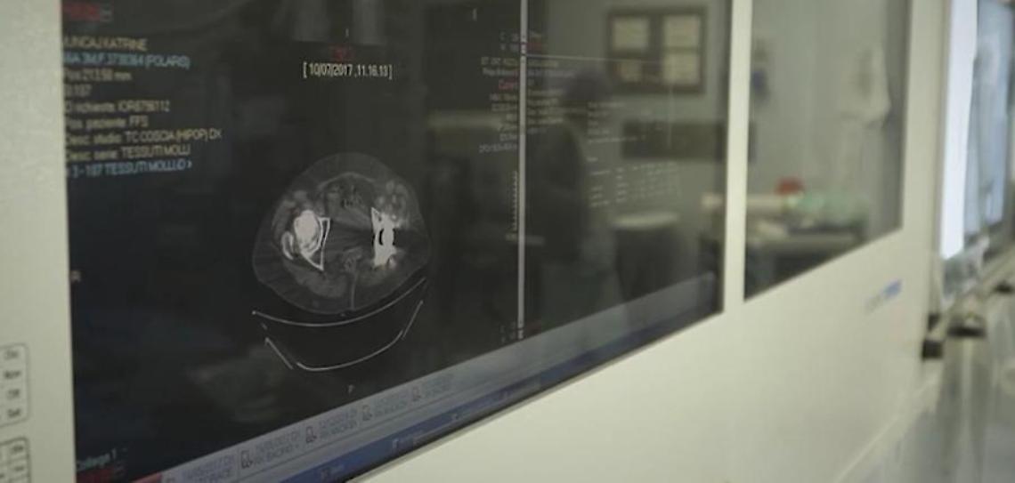 Tumore gastrico metastatico: verso un equo accesso alle cure su tutto il territorio nazionale
