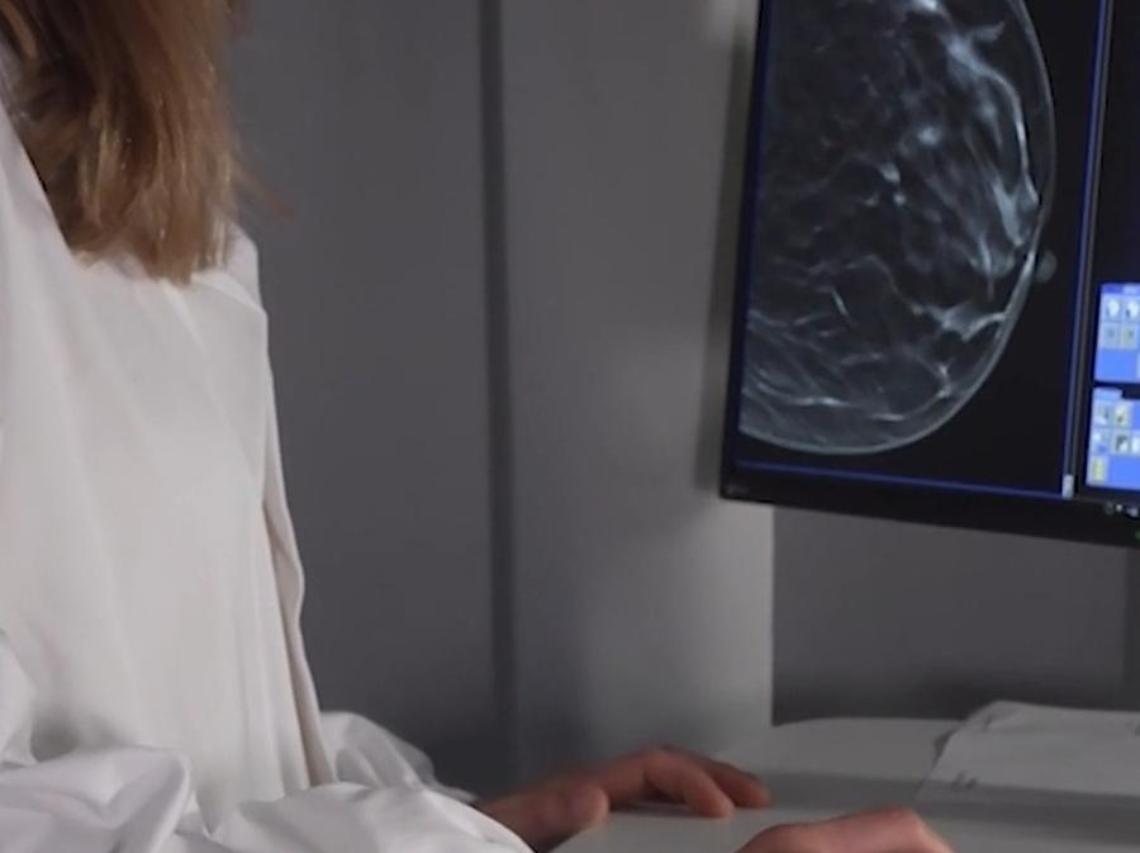 Tumori: per prevenzione carcinoma mammella a SYNLAB Manifattura Firenze nuovo mammografo 3D