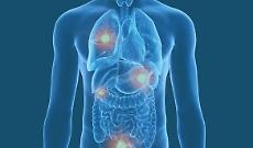Cancro metastatico, la scienza avanza e iniziano grandi speranze